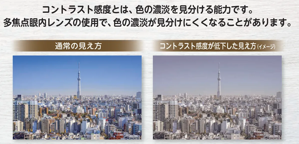 多焦点眼内レンズ特有の見え方